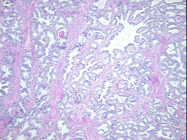 4x Image