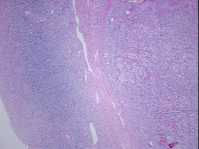 4x Image