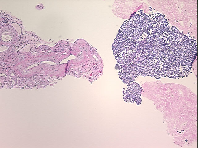 4x Image