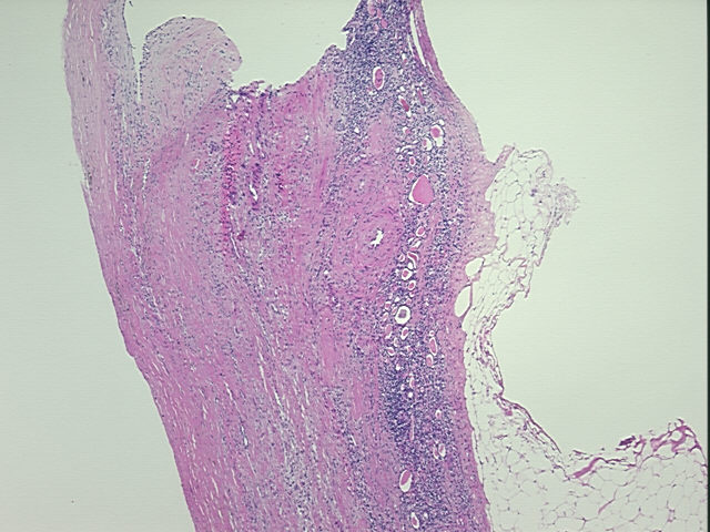 4x Image