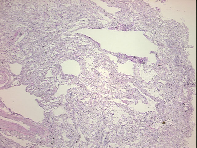 4x Image