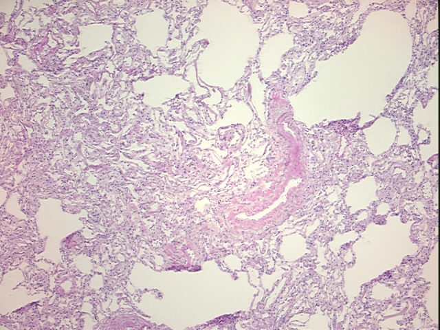 4x Image