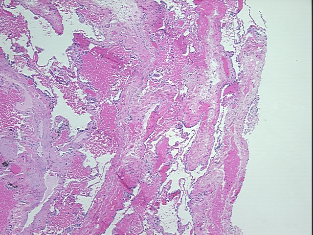 4x Image