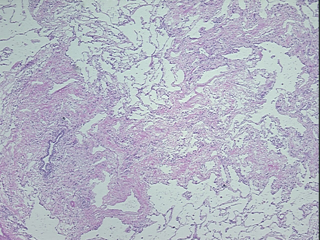 4x Image