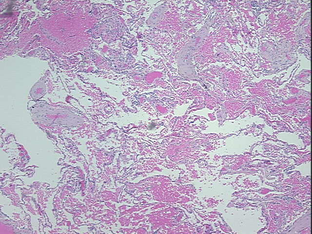 4x Image