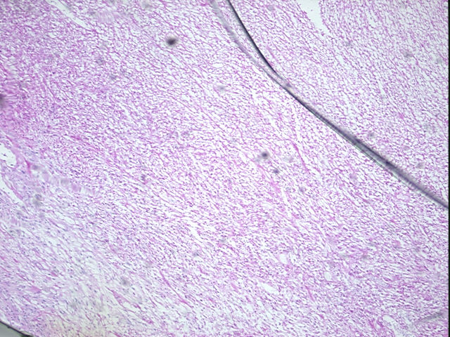 4x Image