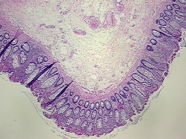 4x Image