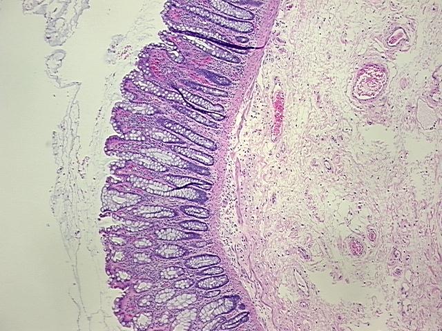 4x Image
