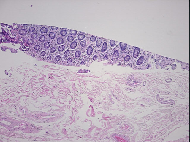 4x Image