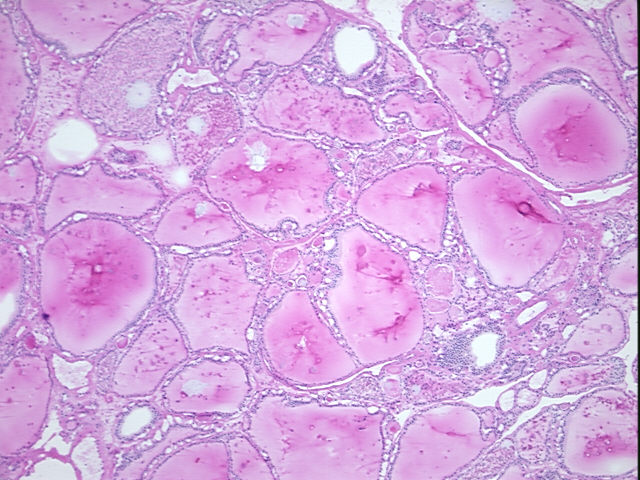 4x Image