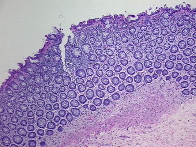 4x Image