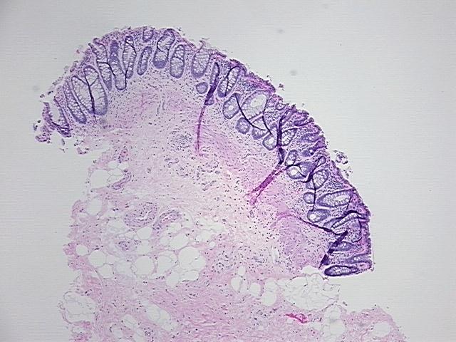 4x Image