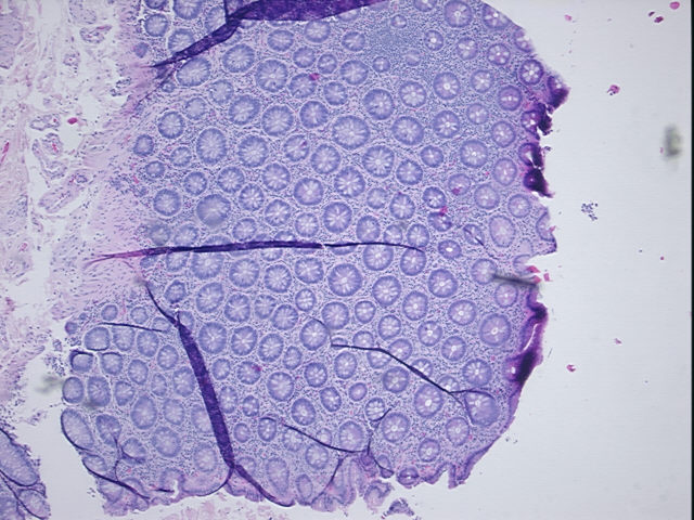 4x Image