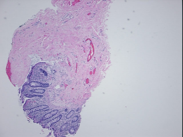 4x Image