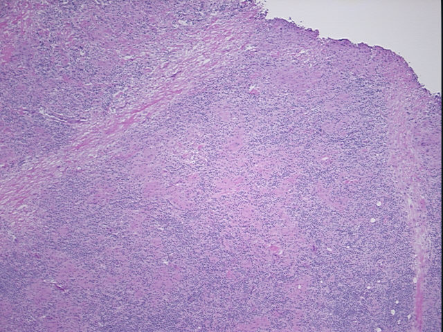 4x Image
