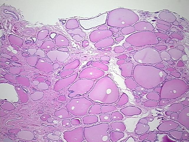 4x Image