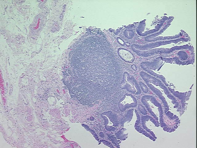 4x Image