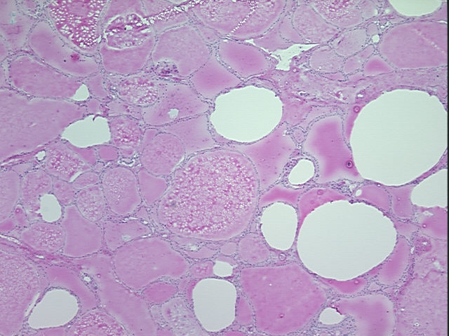 4x Image