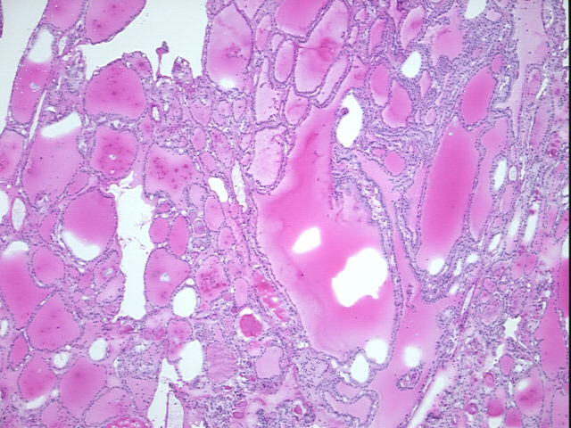 4x Image