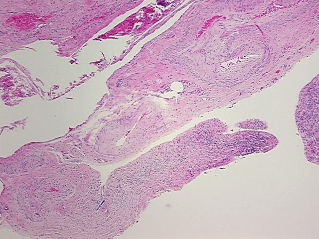 4x Image