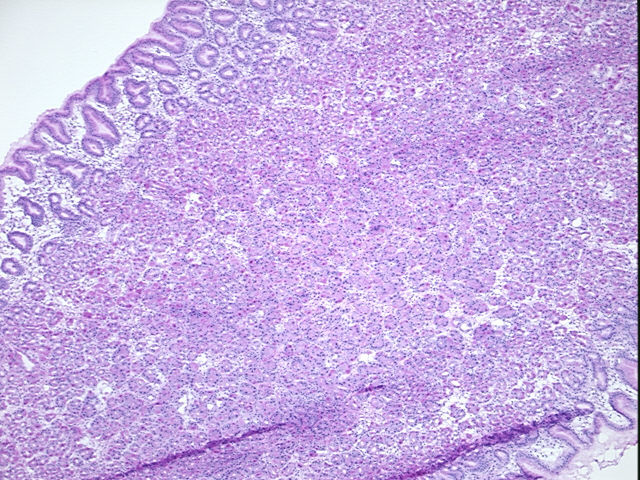 4x Image