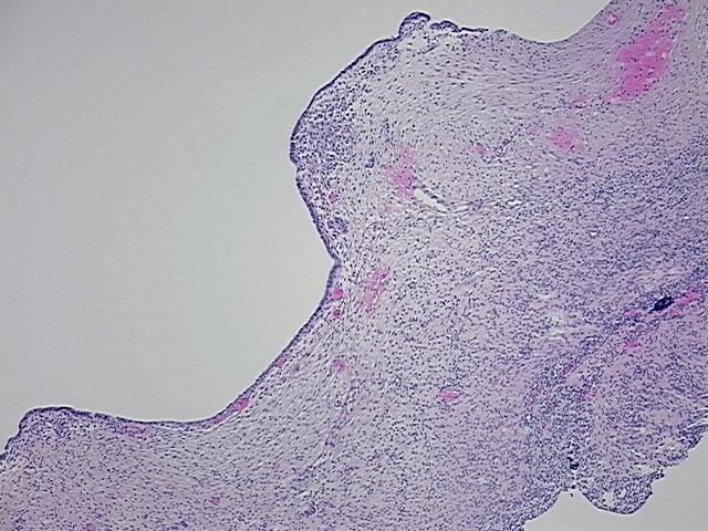 4x Image