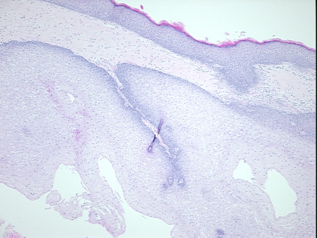 4x Image
