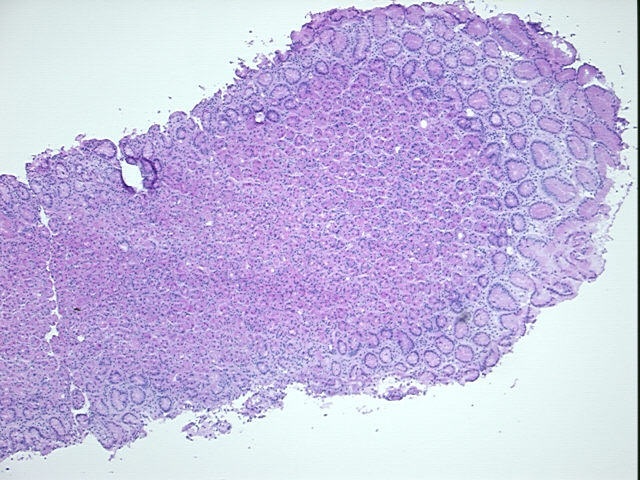 4x Image