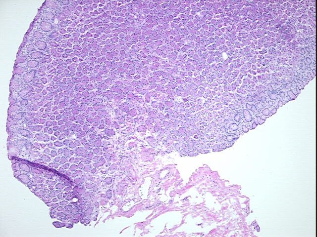 Frozen Tissue Sections, Stomach