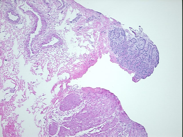 4x Image