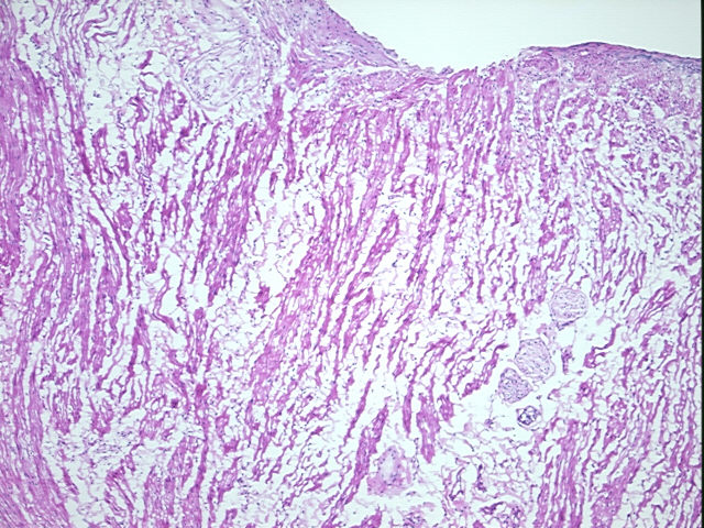 4x Image