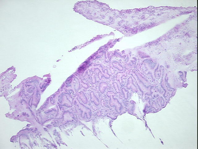 4x Image