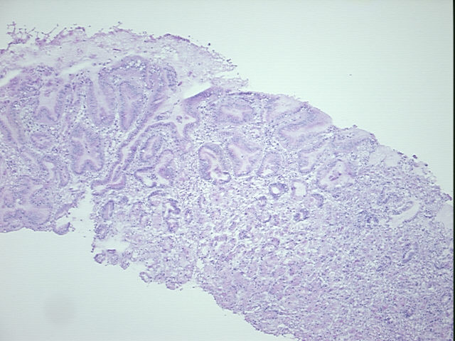 4x Image