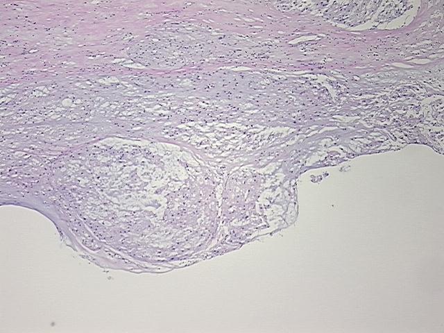 4x Image