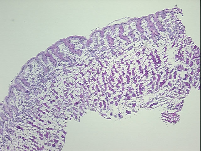 4x Image