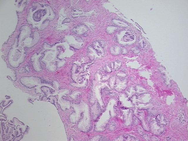 4x Image