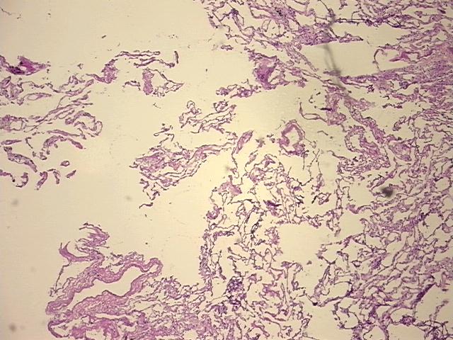 4x Image