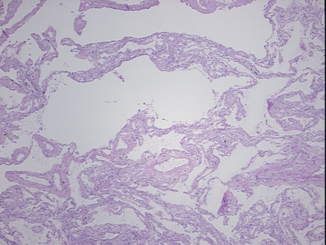 4x Image