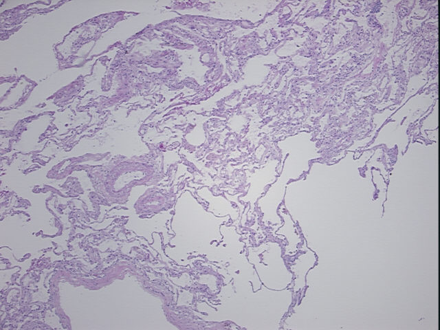 4x Image