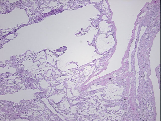 4x Image