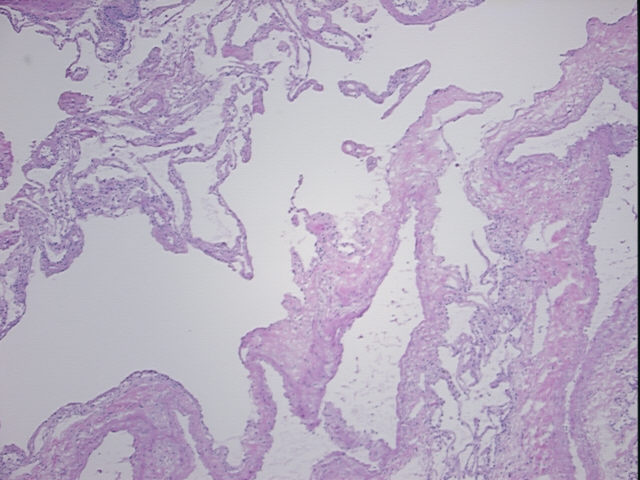 4x Image