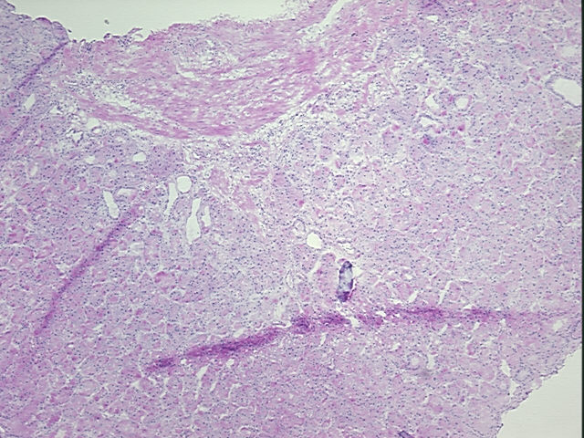4x Image