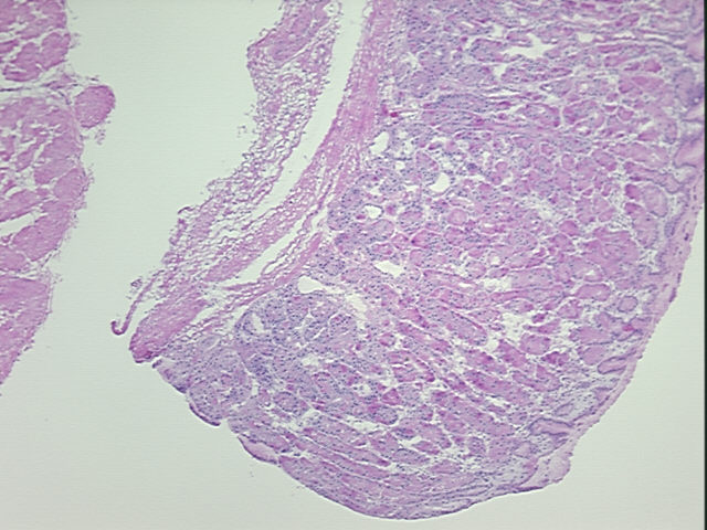 4x Image