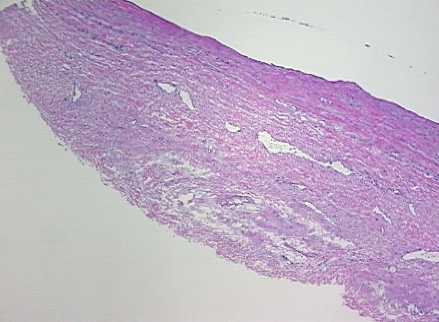 4x Image