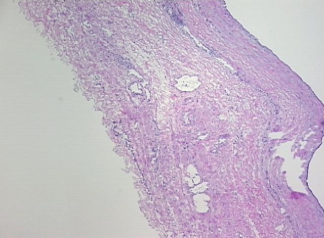 4x Image