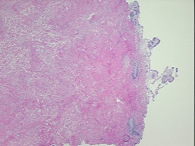 4x Image