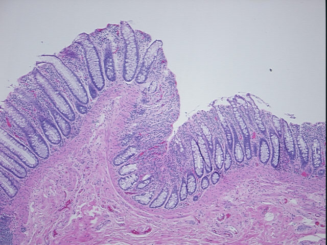 4x Image