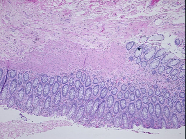 4x Image