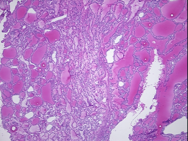 4x Image