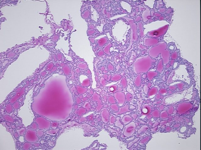 4x Image